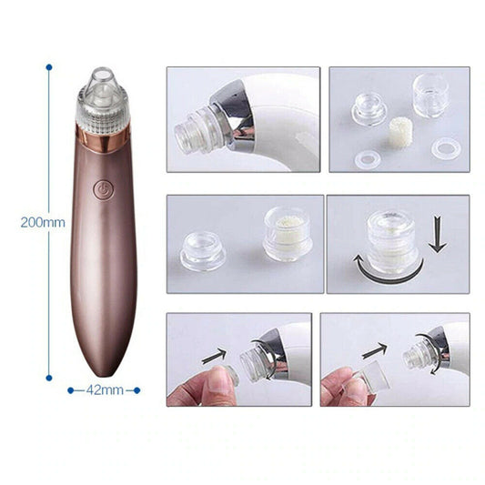 Electric Blackhead Remover – Strong Suction Pore Vacuum & Skin Cleaner