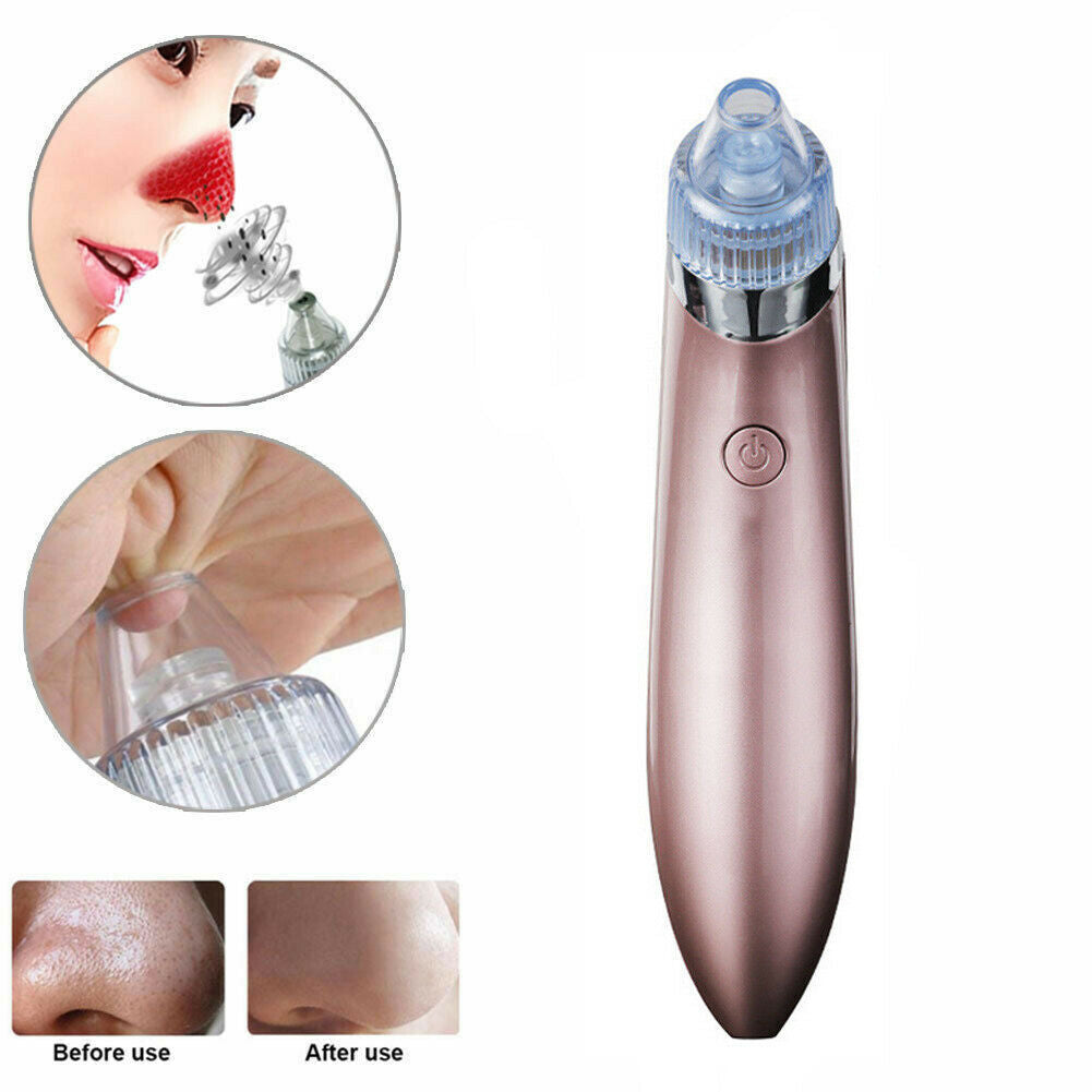 Electric Blackhead Remover – Strong Suction Pore Vacuum & Skin Cleaner