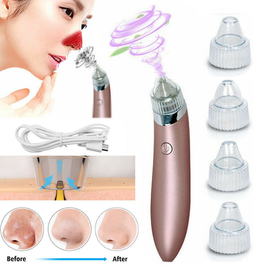 Electric Blackhead Remover – Strong Suction Pore Vacuum & Skin Cleaner