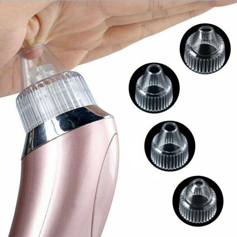 Electric Blackhead Remover – Strong Suction Pore Vacuum & Skin Cleaner