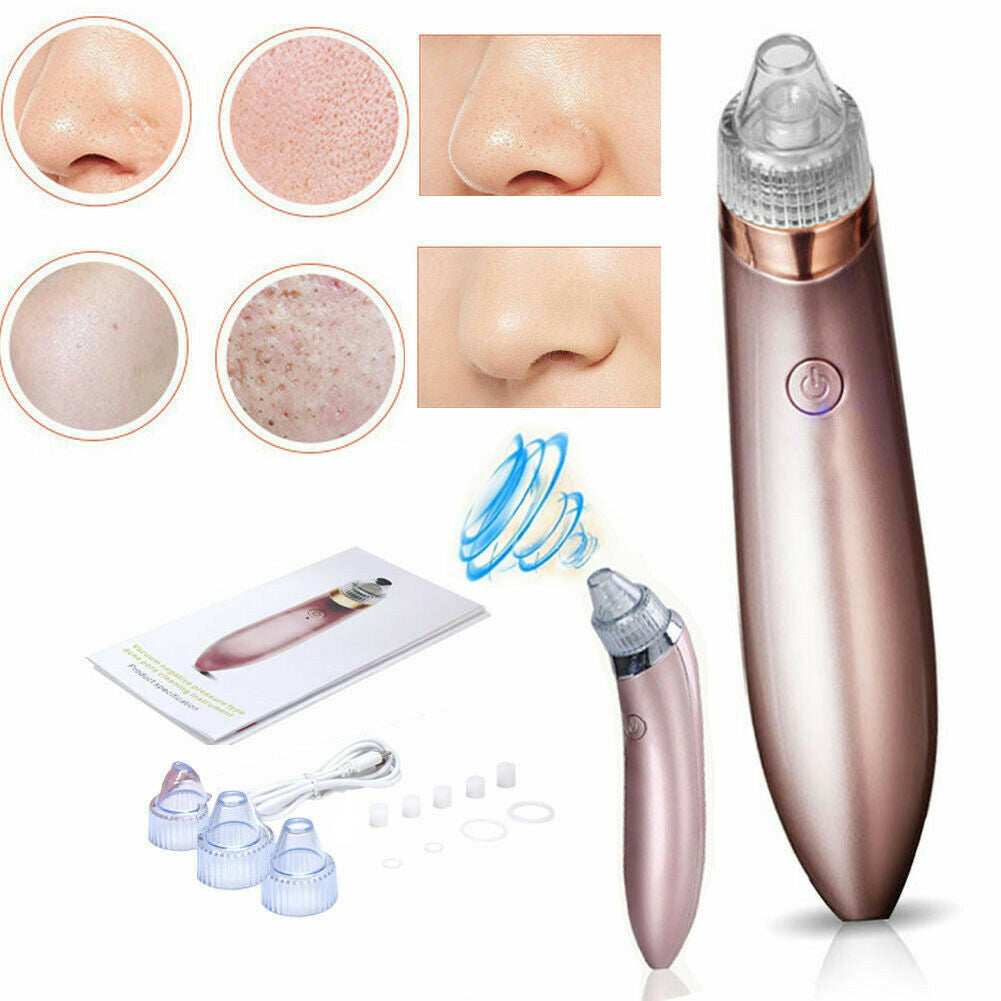 Electric Blackhead Remover – Strong Suction Pore Vacuum & Skin Cleaner